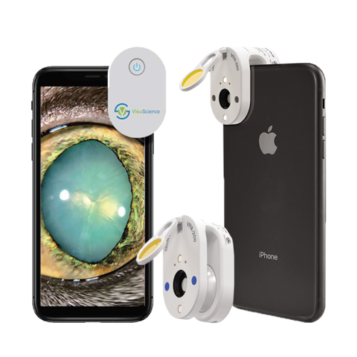 Smartphone Eye Imagine Adapter
